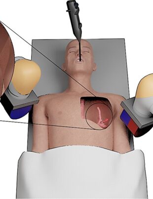 VIDEO. Cancerul pulmonar, tratat de un mini robot. Cum arată dispozitivul dezvoltat de cercetătorii de la Universitatea din Leeds