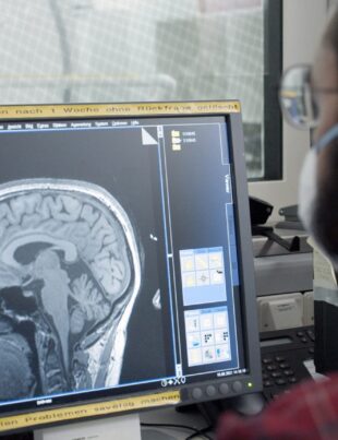 FDA aprobă primul medicament care încetinește progresia Alzheimer. Cât costă tratamentul