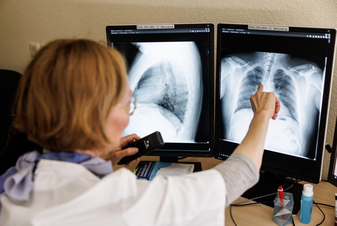 Ai grijă de tine. Numărul cazurilor de cancer crește în rândul tinerilor