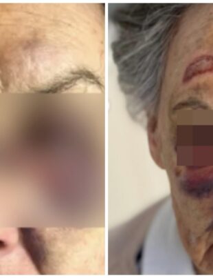 Un cerșetor român din Italia a fost la un pas să ucidă o pensioară. Motivul halucinant pentru care a desfigurat femeia de 84 de ani