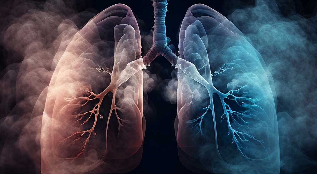 STUDIU. Care ar putea fi cauza cancerului pulmonar?