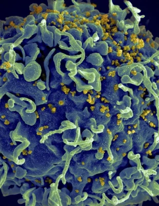 CDC a identificat primul caz de HIV prin proceduri cosmetice
