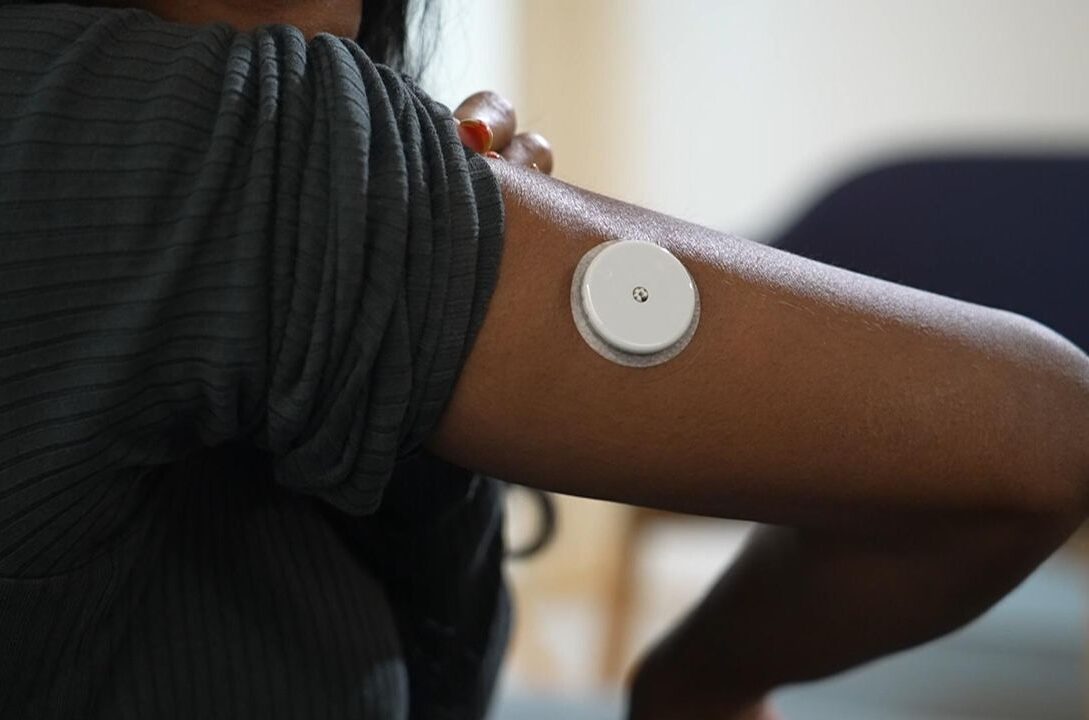 Persoane din Anglia cu diabet de tip 1 vor primi pancreas artificial