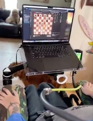 Noland Arbaugh poate opera un computer cu puterea minții