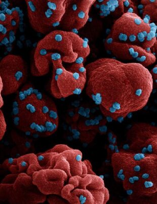 Există o creștere semnificativă a cazurilor de infecție