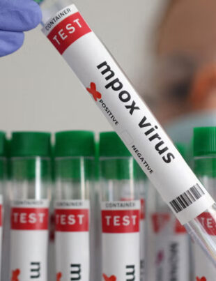 Cazurile noii variante de mpox continuă să se răspândească