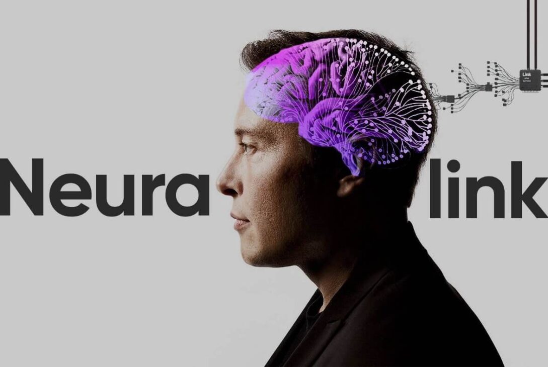 Neuralink implementează al doilea implant de cip cerebral