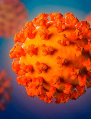 Infecțiile severe cu Covid-19 provoacă inflamație