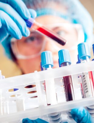 Cercetătorii au descoperit un nou tip de celule cerebrale