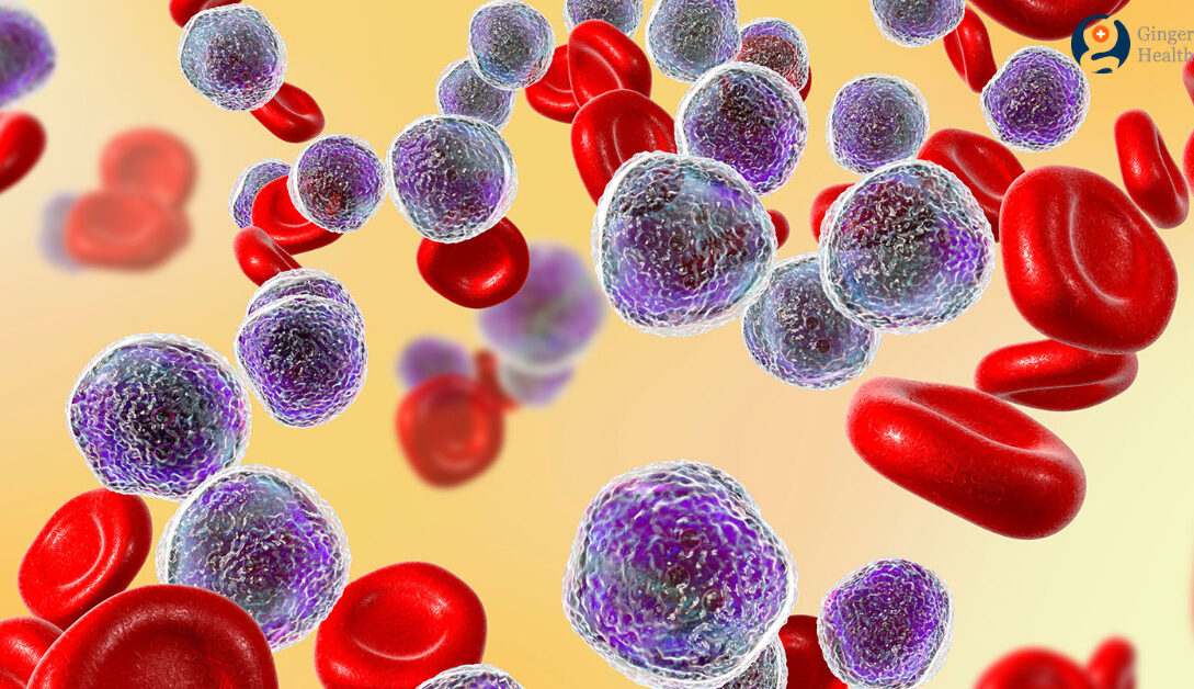 28 Mai este declarată Ziua Mondială a Cancerului de Sânge