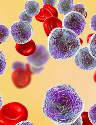 28 Mai este declarată Ziua Mondială a Cancerului de Sânge