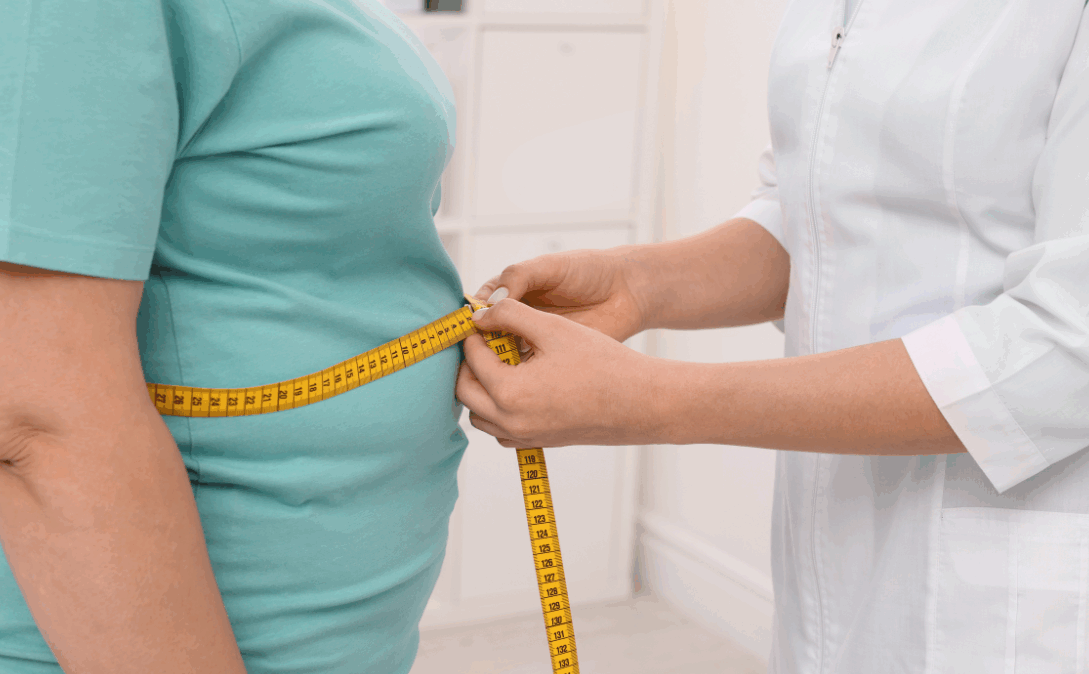 Gradul de obezitate din România a ajuns la 34%