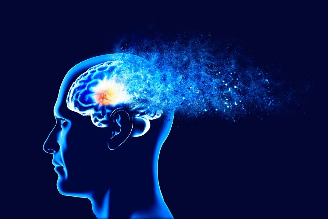 Cercetătorii de la Stanford vin cu vești bune pentru boala Alzheimer
