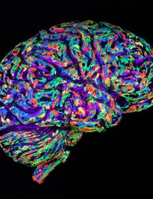 Persoanele optimiste au modele similare de activitate cerebrală