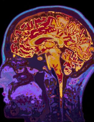 Cercetătorii au descoperit prima semnătură cerebrală a emoțiilor